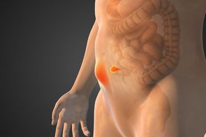 Hernia ombilicală