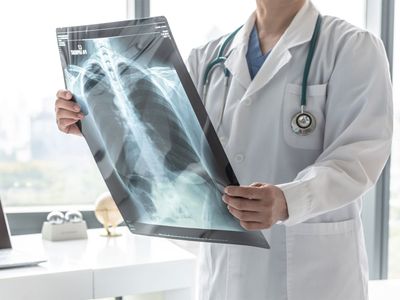 Radiografie digitală