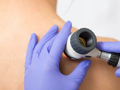 Dermatologie