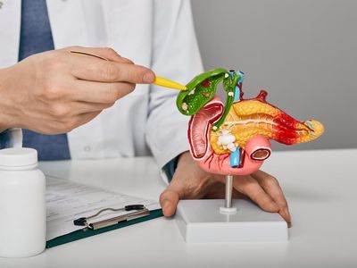 Colecistita litiazică Litiaza veziculară