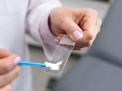 Testare HPV