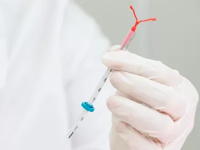 Sterilet. Dispozitiv intrauterin