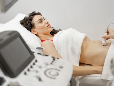 Chist ovarian
