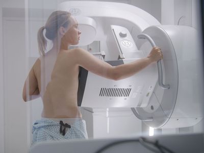 Biopsia stereotaxică sub ghidaj mamografic 3D
