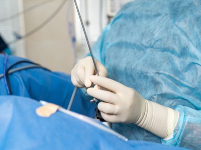 Chirurgia prostatei
