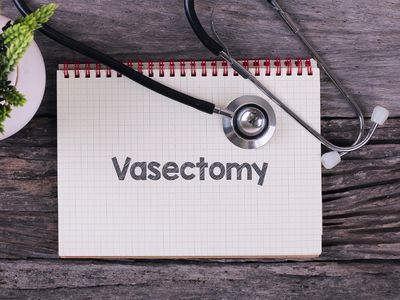 Vasectomia
