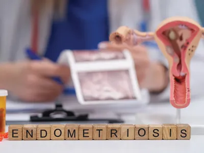 Când ai nevoie să faci operația de endometrioză?