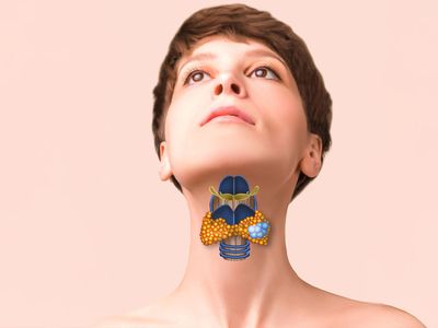 Cancer tiroidian