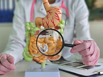 Boala Crohn