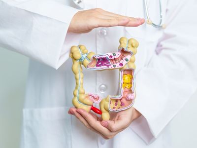 Boala ulceroasă: ulcer gastric și duodenal