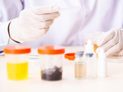 Hematuria
