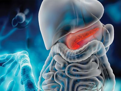 Cancerul de pancreas