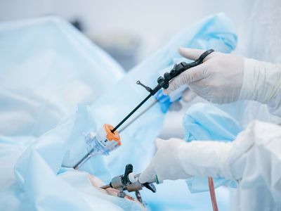 Operația laparoscopică nu te scapă complet de cancerul de colon