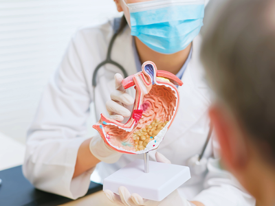 Cancerul gastric