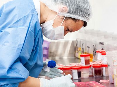 Biopsia ganglionului santinelă