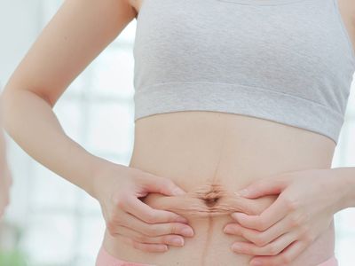 Diastazis abdominal