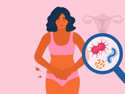 Vaginoza bacteriană