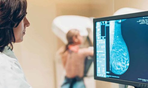 Scorul BIRADS: Riscul de a dezvolta cancer mamar