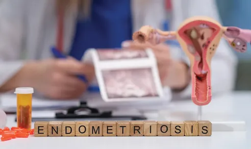 Când ai nevoie să faci operația de endometrioză?