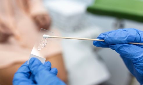 Test Papanicolau în mediu lichid sau convențional