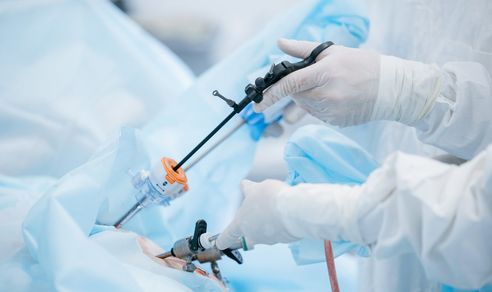 Operația laparoscopică nu te scapă complet de cancerul de colon