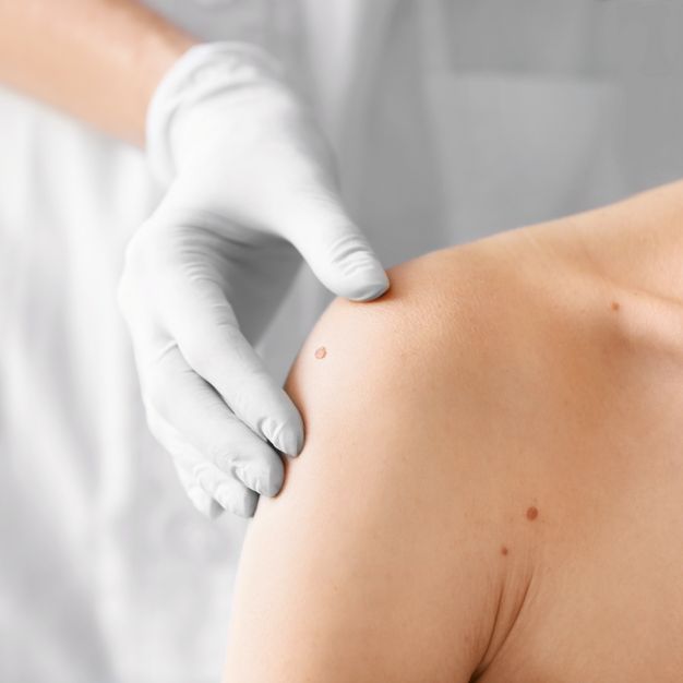 Dermatologie