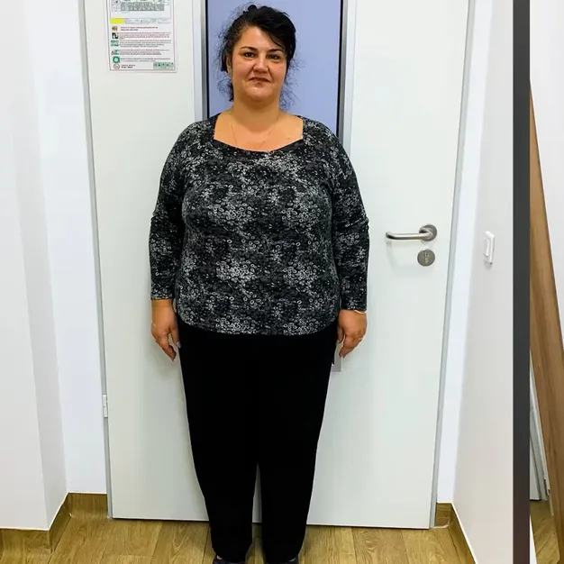 Ilinca, înainte de operația de micșorare a stomacului