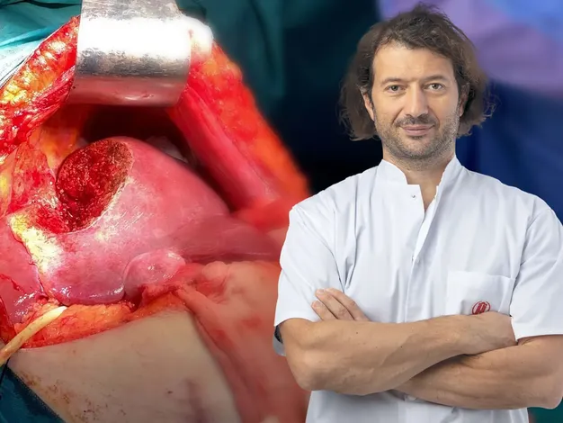 Operații WOW