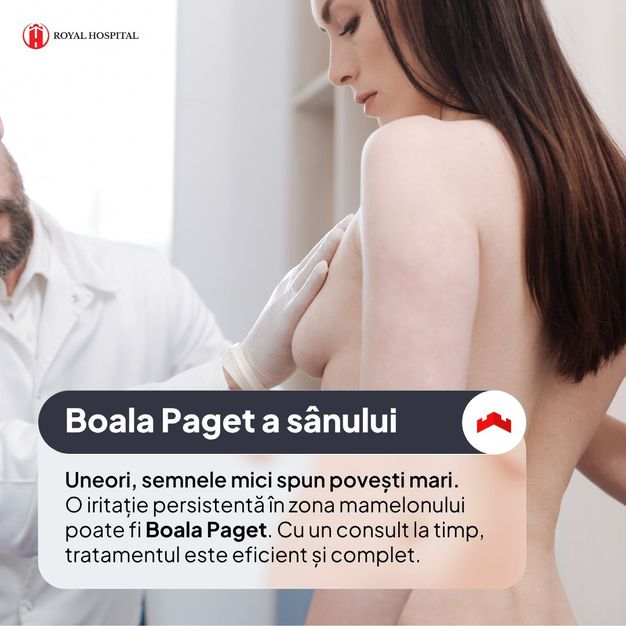 Poate semăna cu o iritație de piele, dar este, de fapt, o formă de cancer mamar superficial.